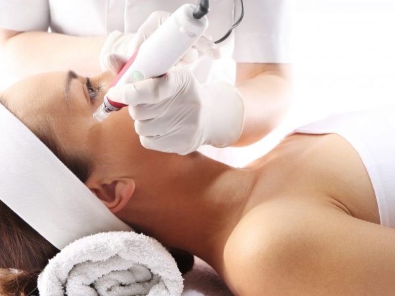 Trị thâm quầng mắt bằng laser có tốt không - 5