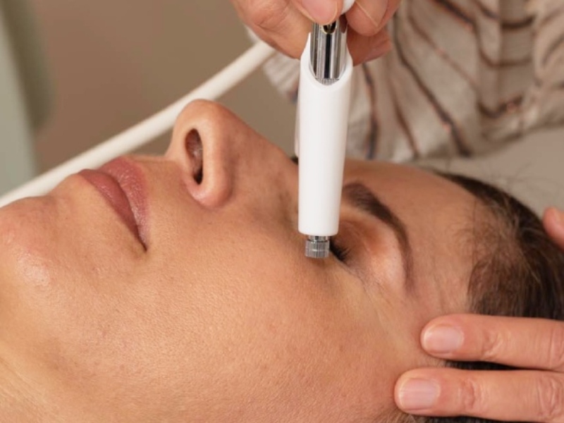 Trị thâm mắt bằng laser - 4