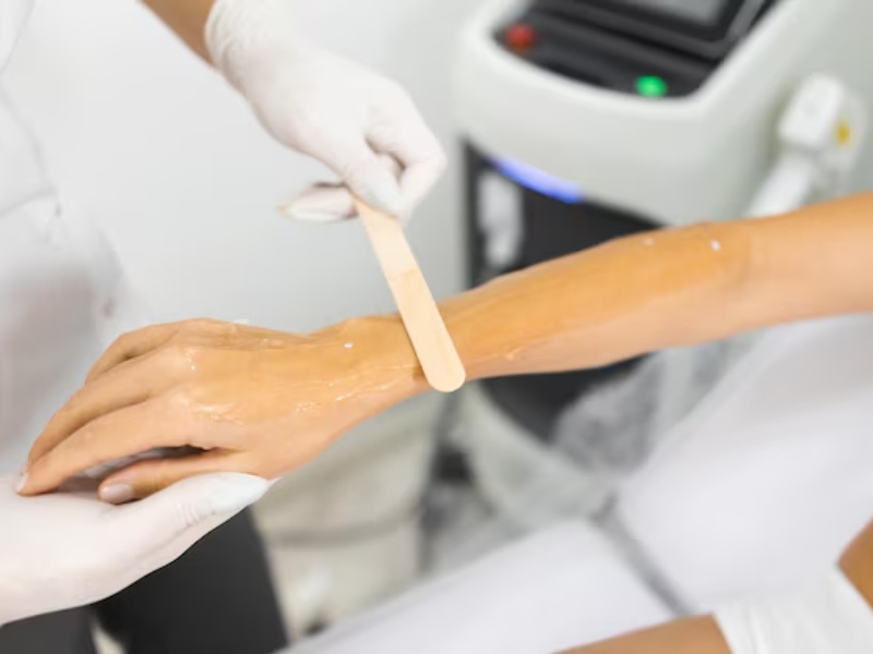 trị viêm nang lông bằng laser - 6
