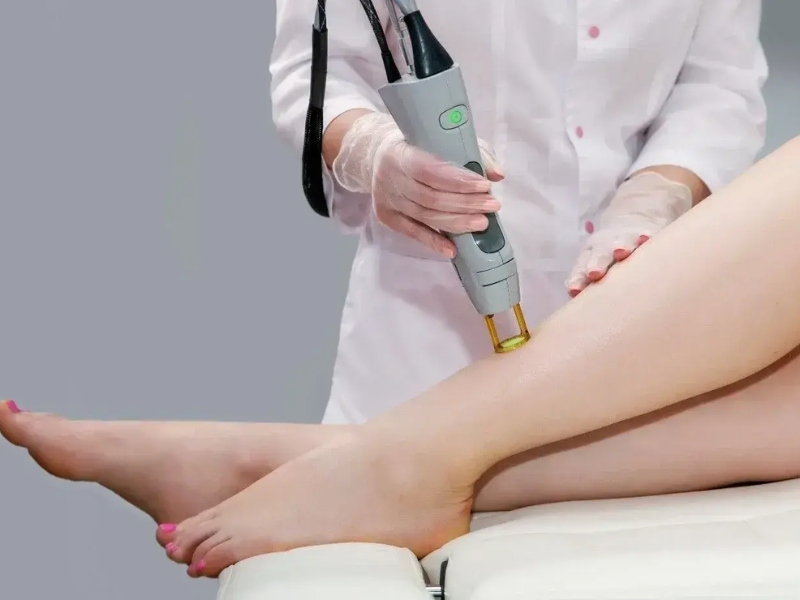 trị viêm nang lông bằng laser - 9