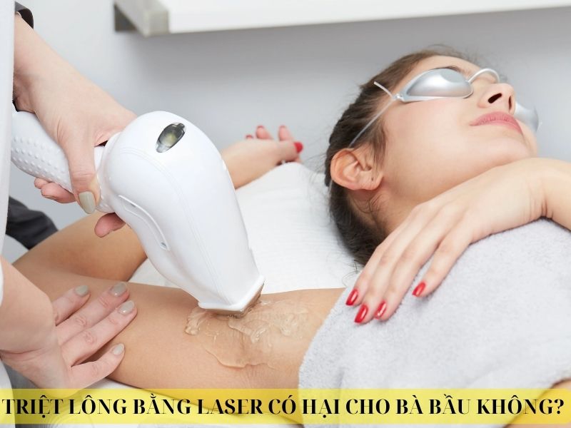 Triệt lông bằng laser có hại cho bà bầu không - 1