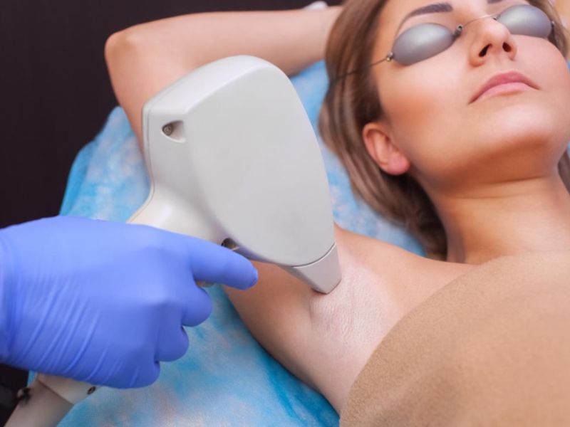 Triệt lông bằng laser có hại cho bà bầu không - 4