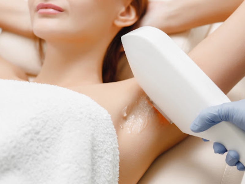 Triệt lông công nghệ ipl có tốt không - 2