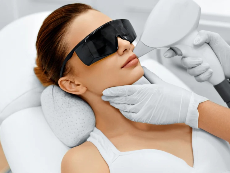 Triệt lông mặt bằng laser - 1