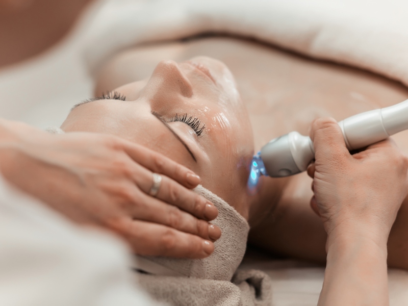 Triệt lông mặt bằng laser - 10