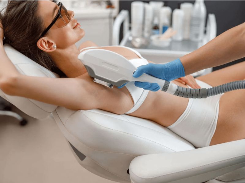 Triệt lông nách bằng tia laser - 10