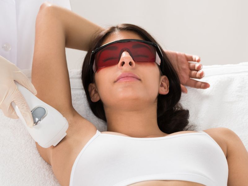 Triệt lông nách bằng tia laser - 11