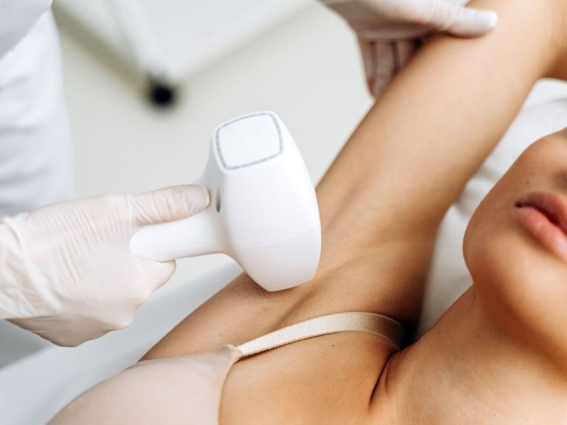Triệt lông nách bằng tia laser - 8