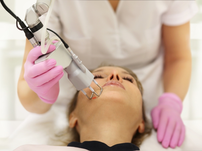 cách sử dụng máy laser toning - 3