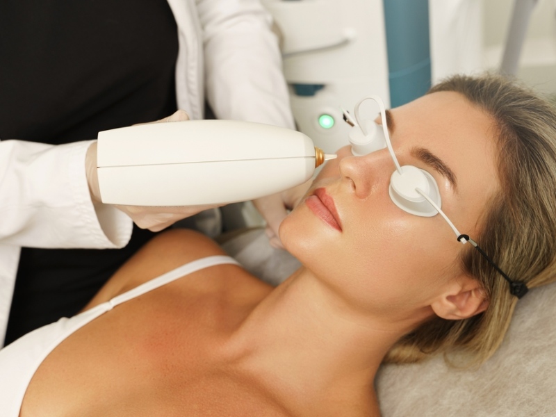 cách sử dụng máy laser toning - 4