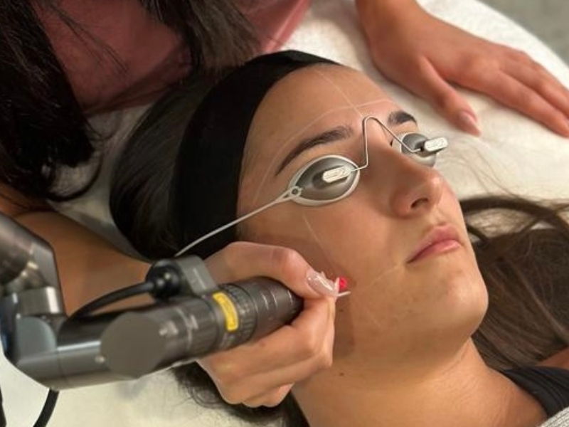 cách sử dụng máy laser toning - 5