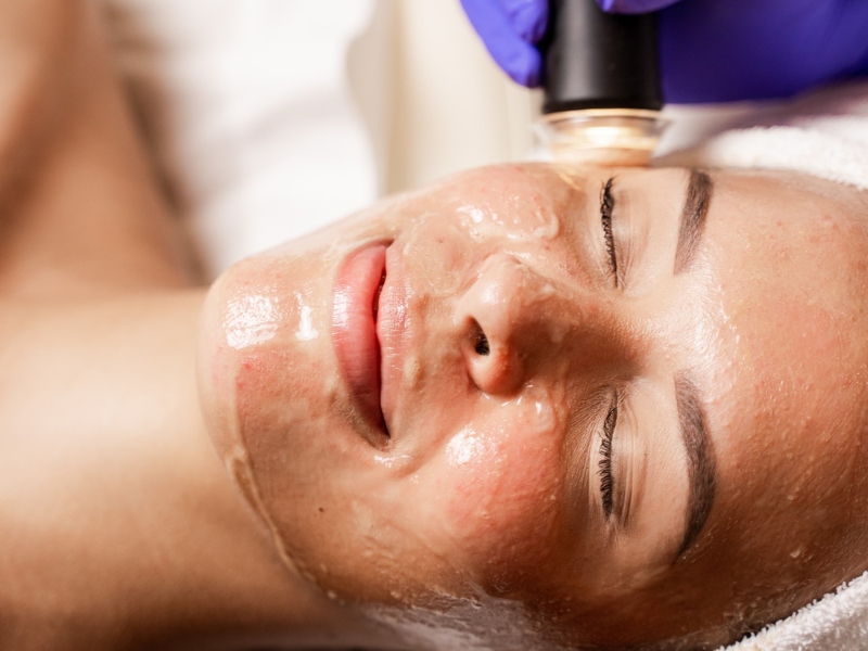 điện di collagen - 1