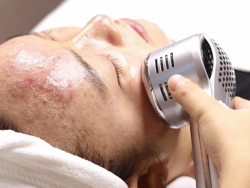 điện di trị mụn là gì - 1