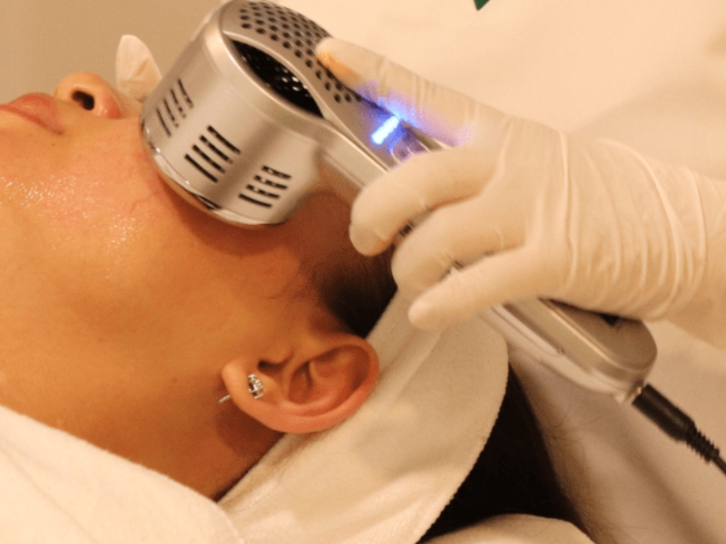 điện di trị mụn là gì - 2