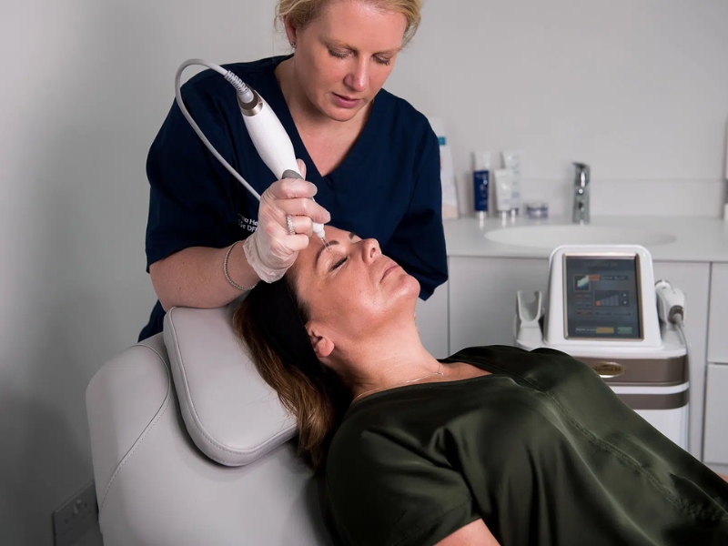 Điều trị dày sừng ánh nắng bằng plasma - 3