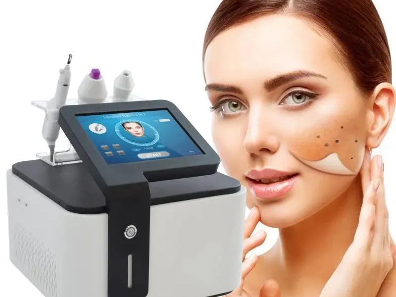 máy plasma lạnh giá bao nhiêu - 1