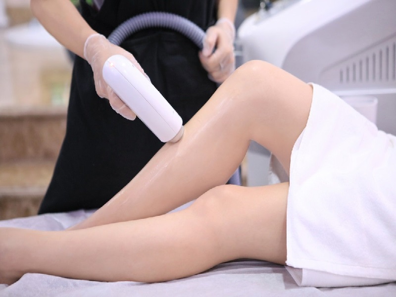 Triệt lông bằng ánh sáng sinh học - 2