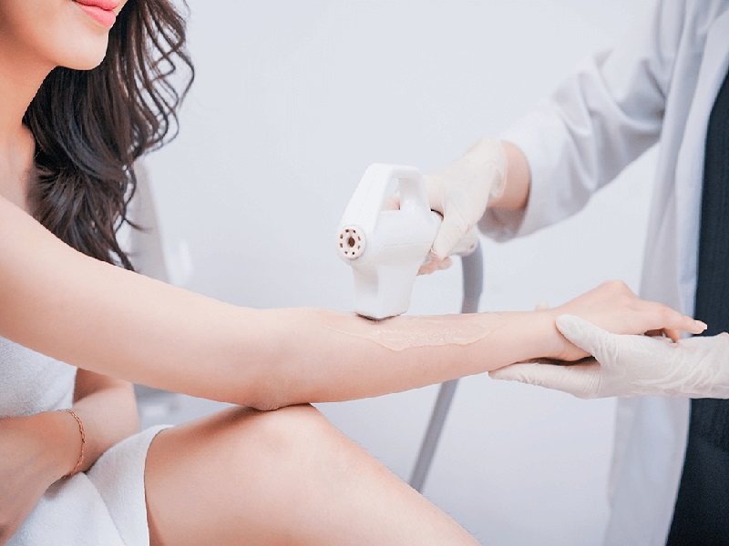 Triệt lông bằng ánh sáng sinh học - 4